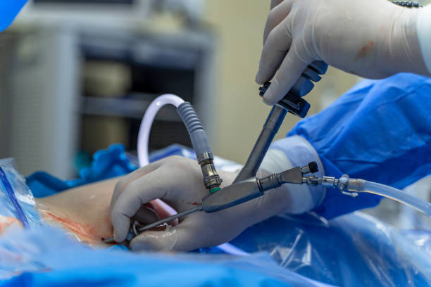 Endoscopic Uro-Oncology