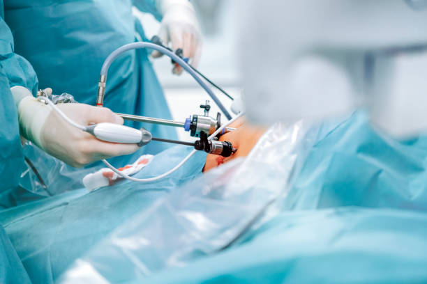 Laparoscopic Uro-Oncology