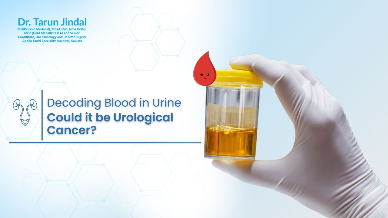 Decoding Blood in Urine: Could it be Urological Cancer?