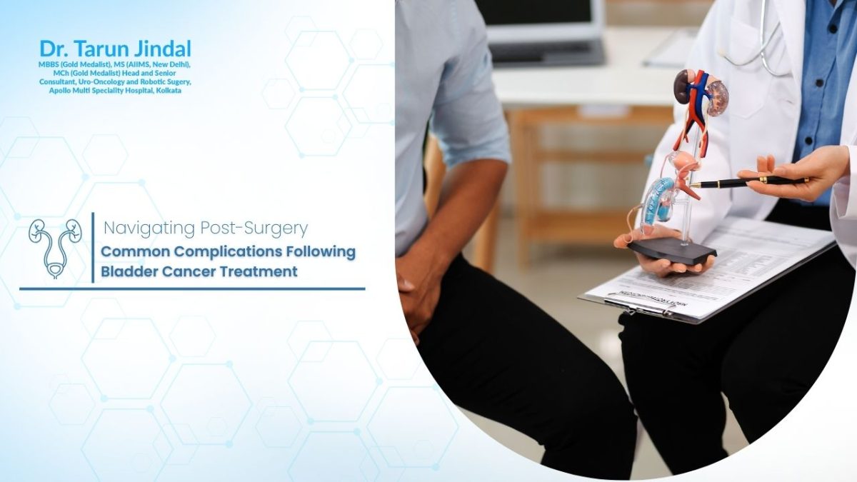 Bladder Cancer Treatment