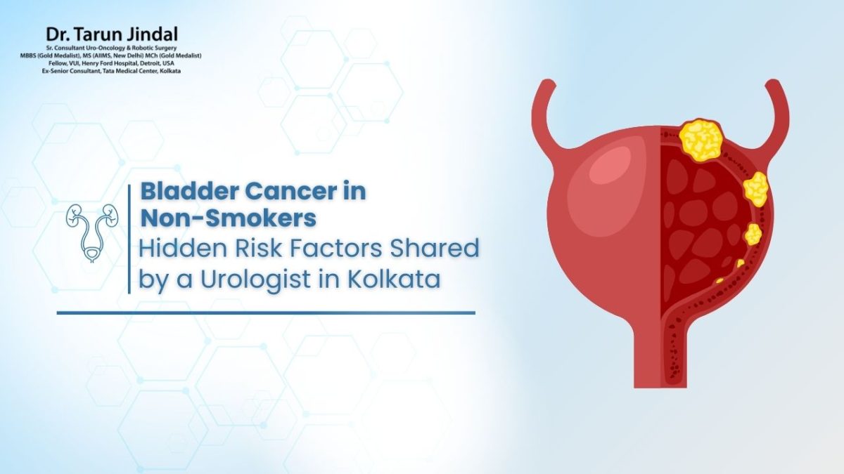 Bladder Cancer in Non-Smokers