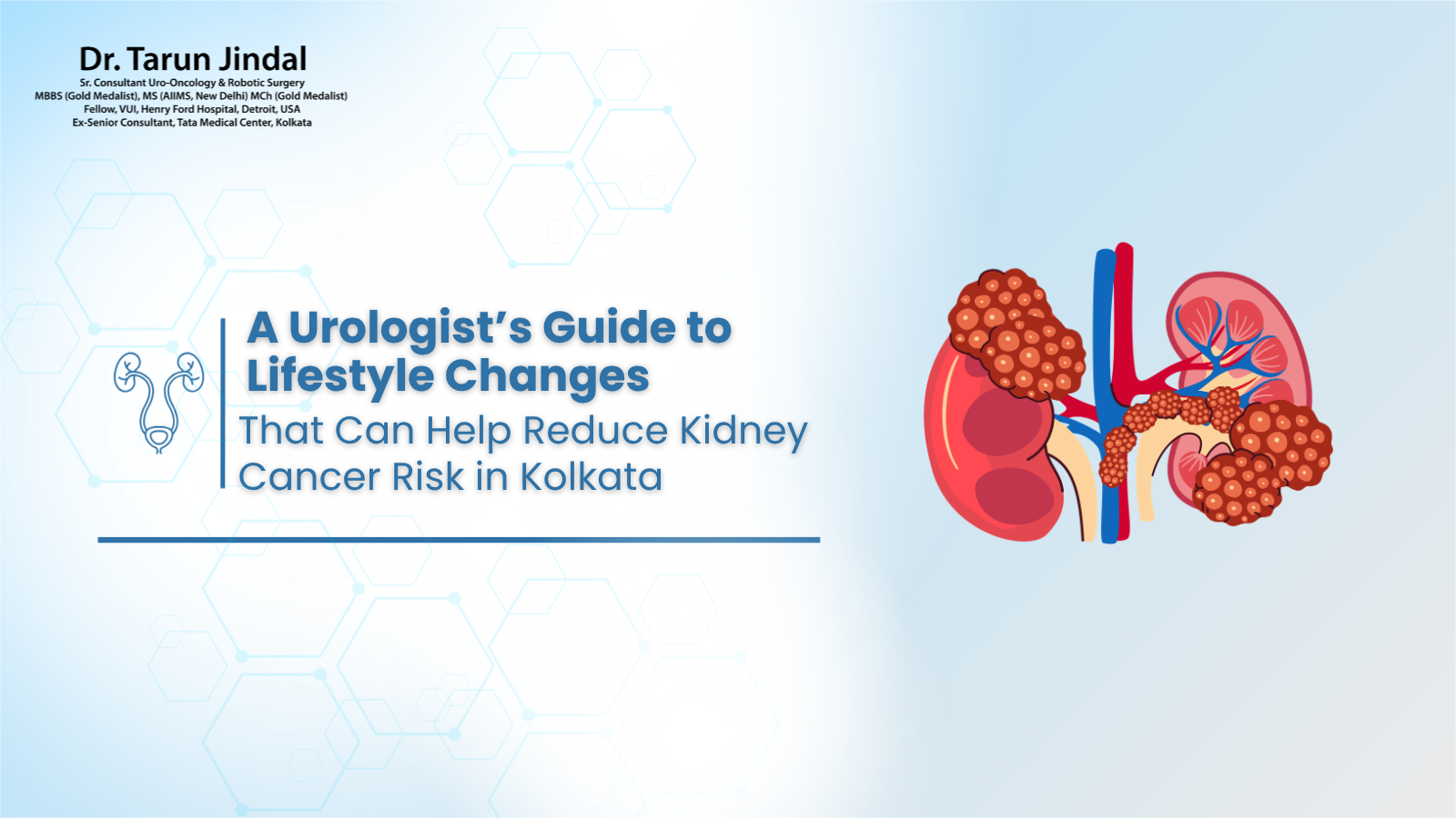 A Urologist’s Guide to Lifestyle Changes That Can Help Reduce Kidney Cancer Risk in Kolkata