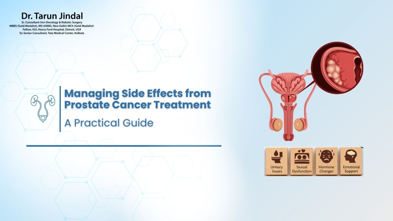 Managing Side Effects from Prostate Cancer Treatment: A Practical Guide