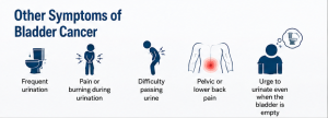 Other Symptoms of Bladder Cancer