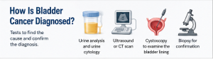 How Is Bladder Cancer Diagnosed?