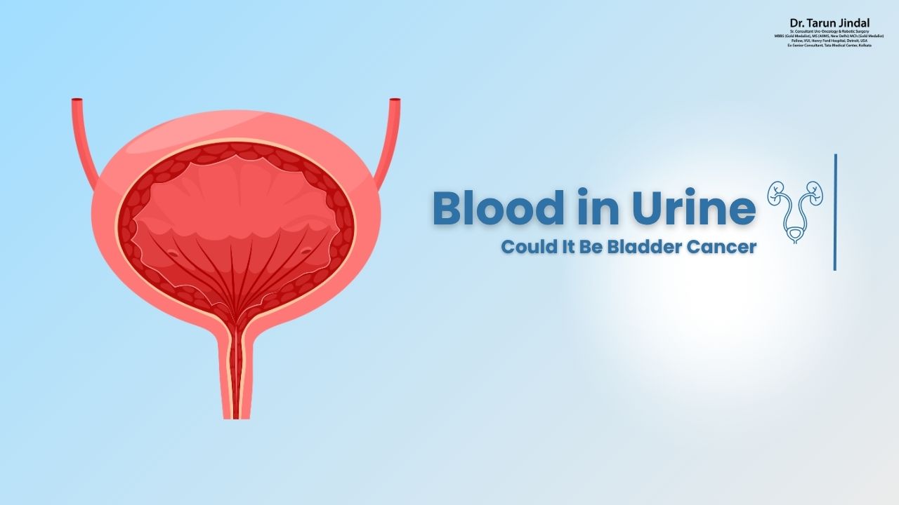 Blood in Urine: Could It Be Bladder Cancer? – Listen to the Top Urologist in Kolkata